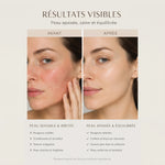 Comparatif de visages légendés avant et après annonçant réduction des rougeurs, confort, texture plus lisse et hydratation après 28 jours.
