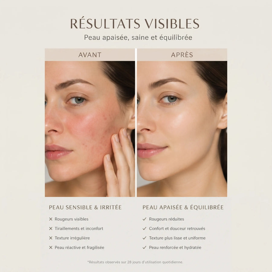 Comparatif de visages légendés avant et après annonçant réduction des rougeurs, confort, texture plus lisse et hydratation après 28 jours.